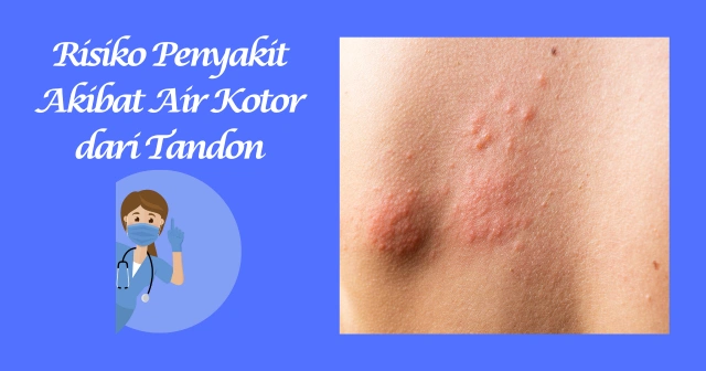 Risiko Penyakit Akibat Air Kotor dari Tandon